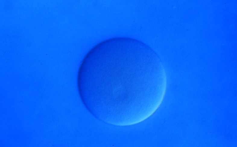 L. variegatus unfertilized egg [J. Hardin]