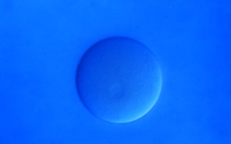 L. variegatus unfertilized egg [J. Hardin]