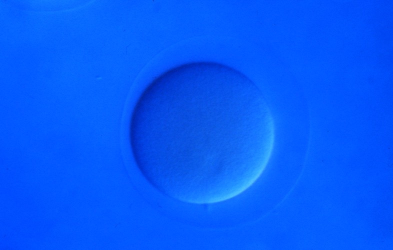 L. variegatus fertilized egg [J. Hardin]