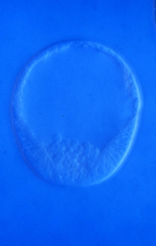 L. variegatus mesenchyme blastula [J. Hardin]