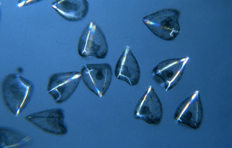 S. purpuratus early plutei - polarization microscopy [J. Hardin]
