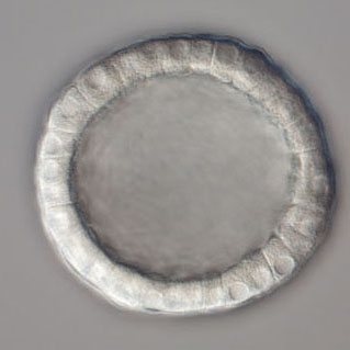 blastula