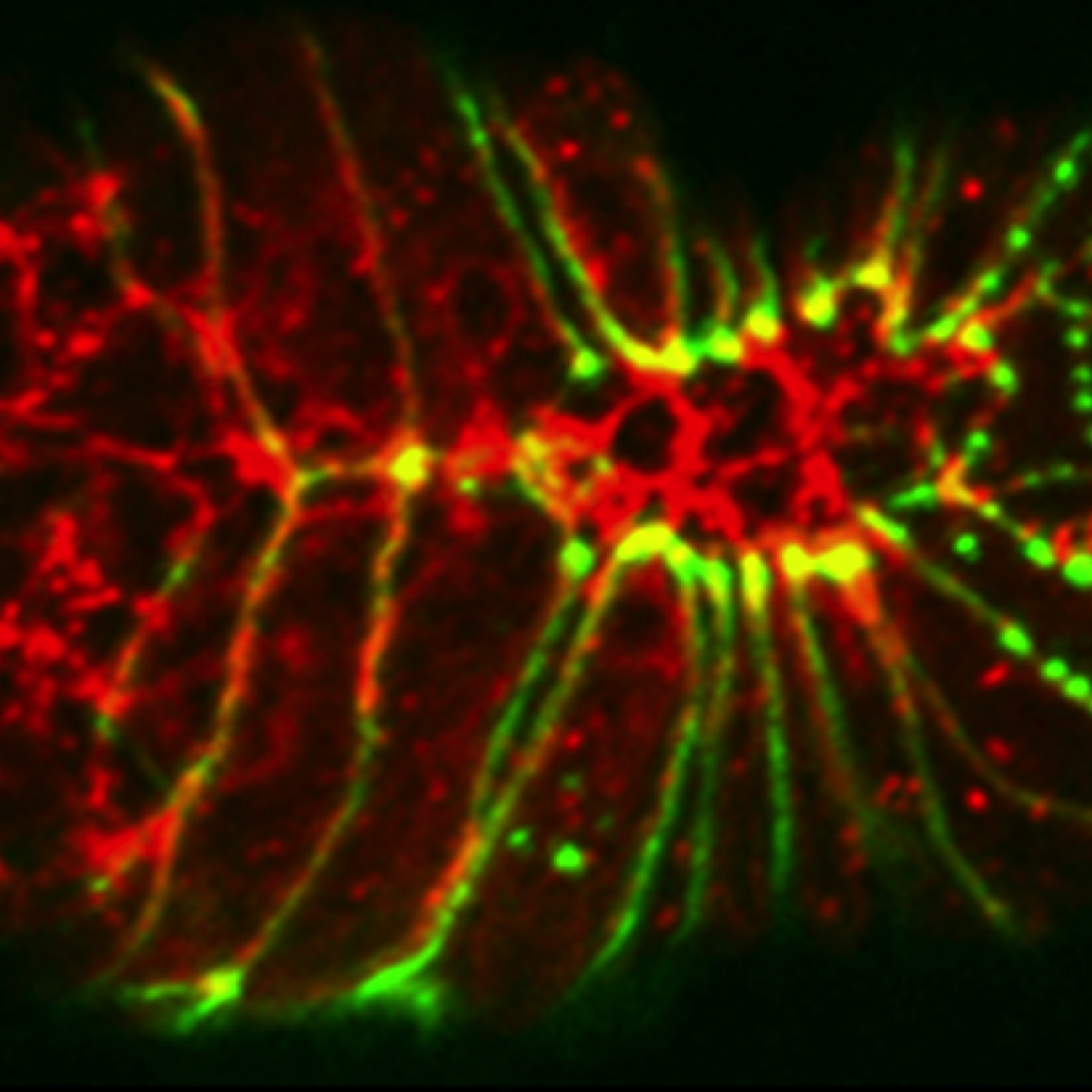 AJM-1 (green) and actin (red) - ventral enclosure [C. Thomas-Virnig]