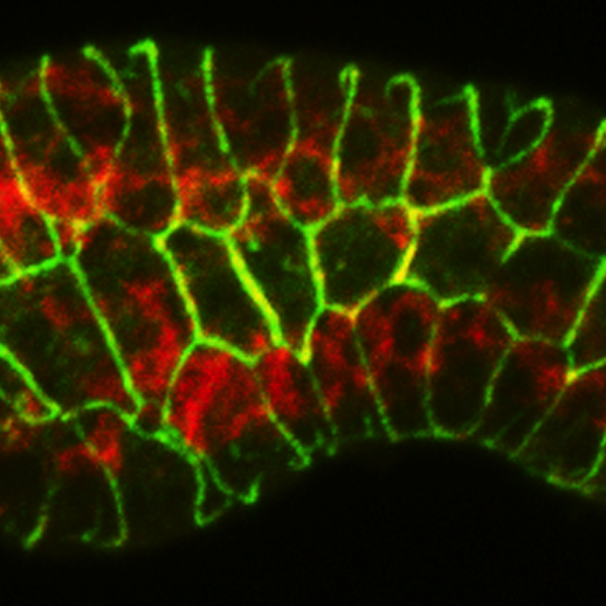 muscle (red) and AJM-1 (green) - elongation [P. Heid]