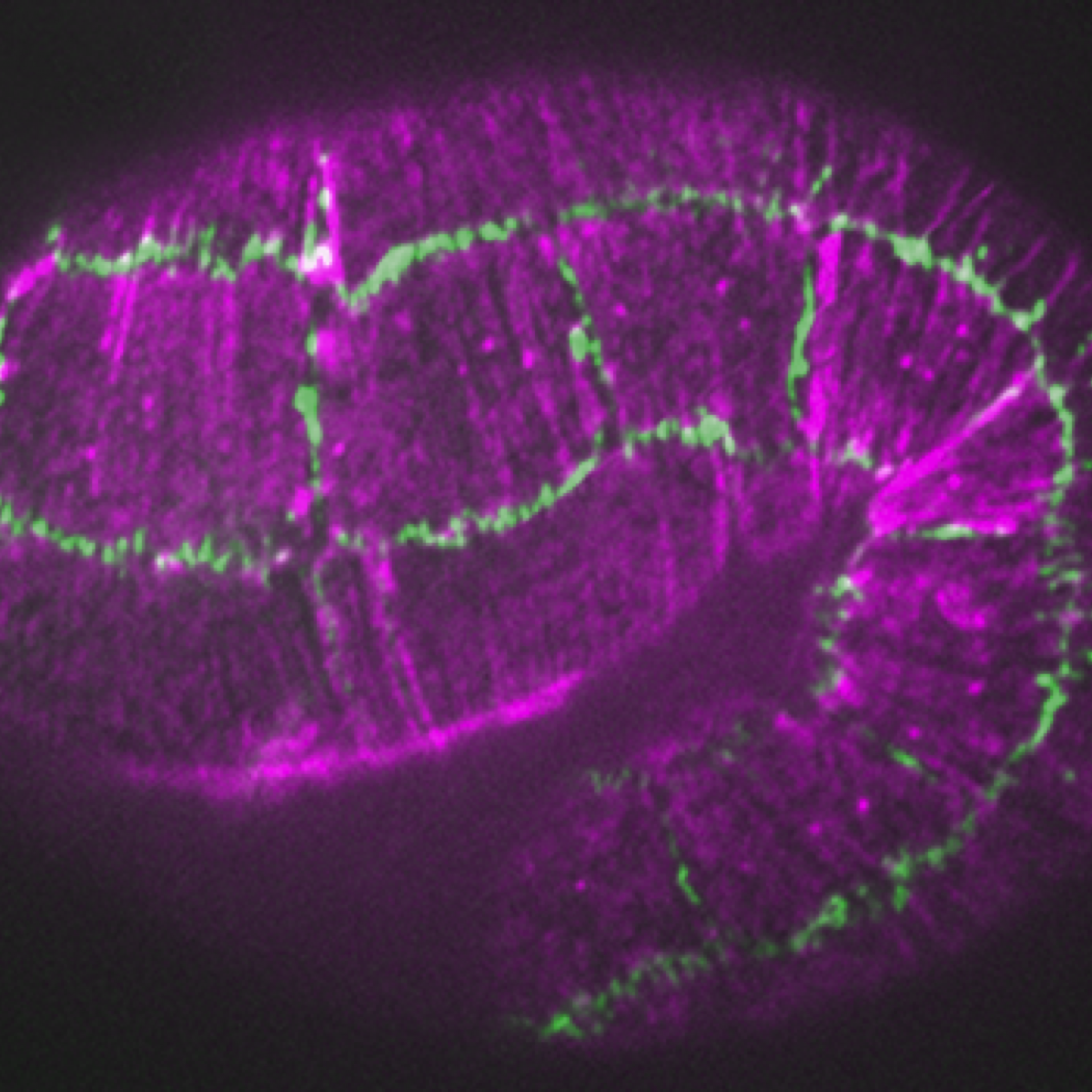 Actin (purple)/JAC-1::GFP (green); hmp-1(fe4) embryo [A. Cox-Paulson]