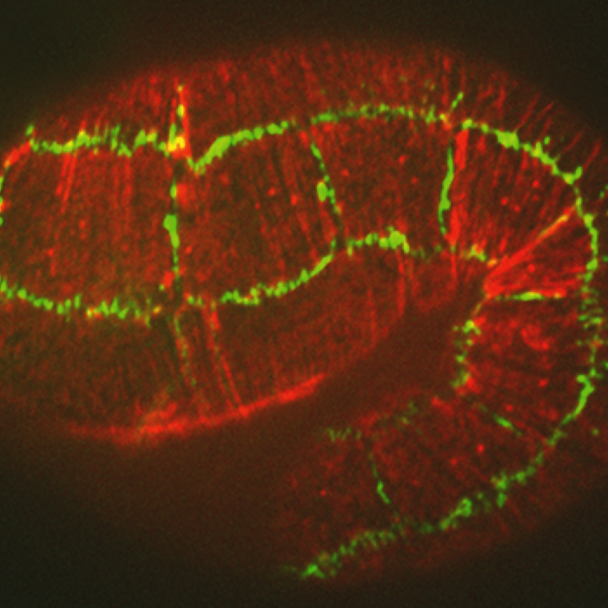 Actin (red)/JAC-1::GFP (green); hmp-1(fe4) embryo [A. Cox-Paulson]