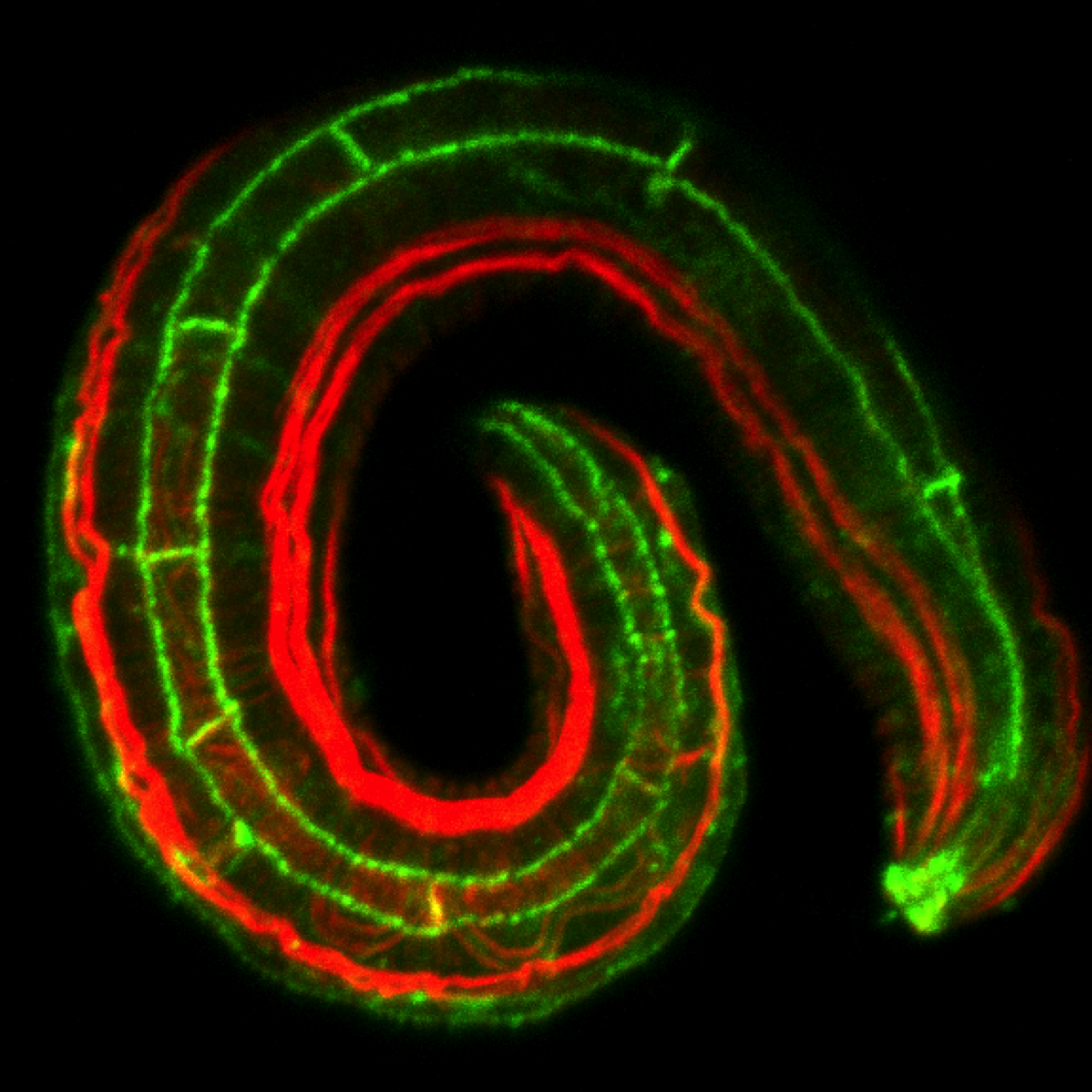 JAC-1::GFP (green)/actin (red)  [A. Cox-Paulson]