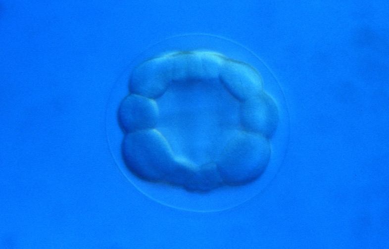 L. variegatus late 16-cell [J. Hardin]