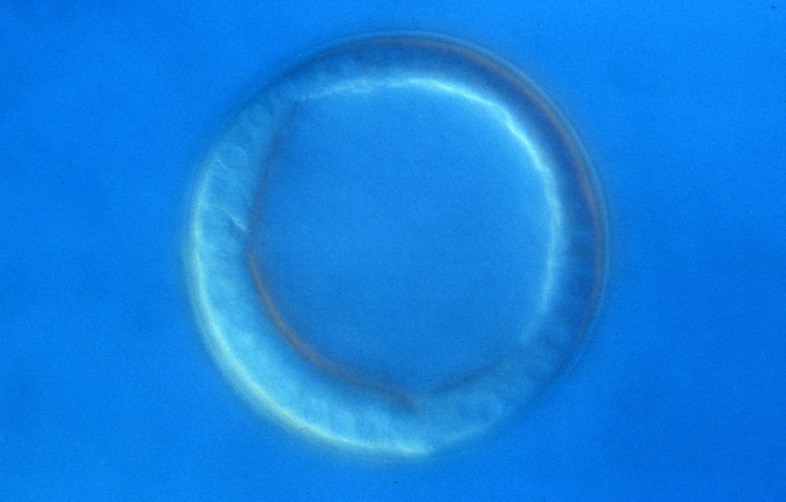 L. variegatus hatched blastula [J. Hardin]