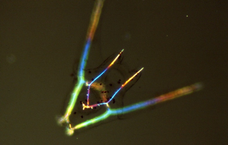 L. variegatus pluteus - polarization microscopy [J. Hardin]