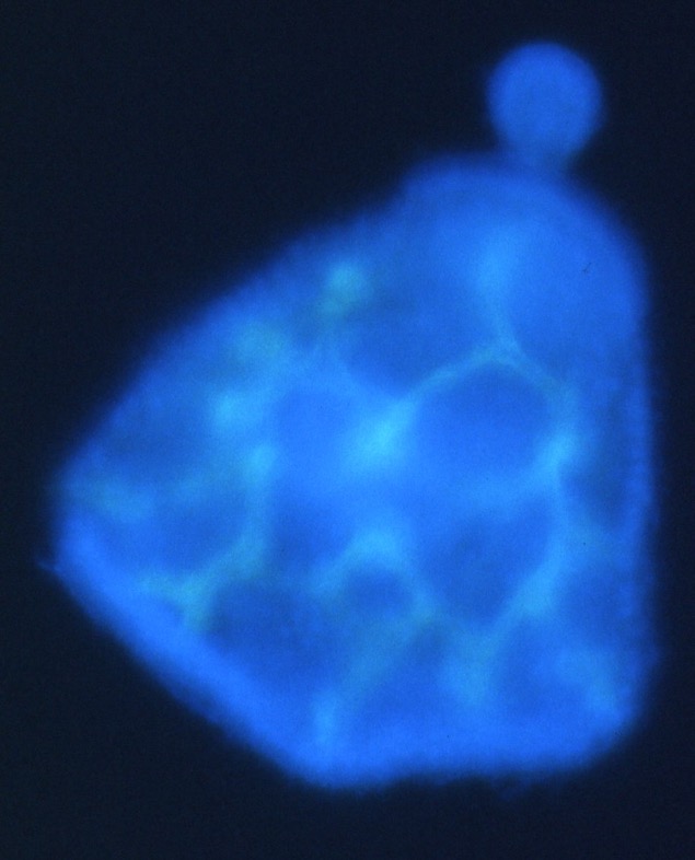 L. variegatus prism - NiCl2 treated (1g8 stained) [J. Hardin]