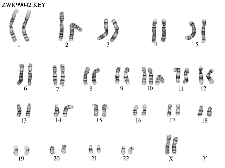 ZooWeb - Karyotypes XY,+10.